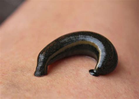 The Connection between Dreams of Leech Attacks and Personal Boundaries