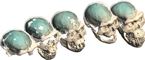 The Enigmatic Origins of the Golden Cranium