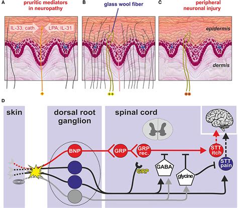 The Fascinating Phenomenon of Unraveling Fibers from the Epidermis 