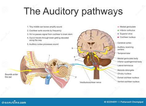 The Fascination of Dreaming about a Hemorrhaging Auditory Organ