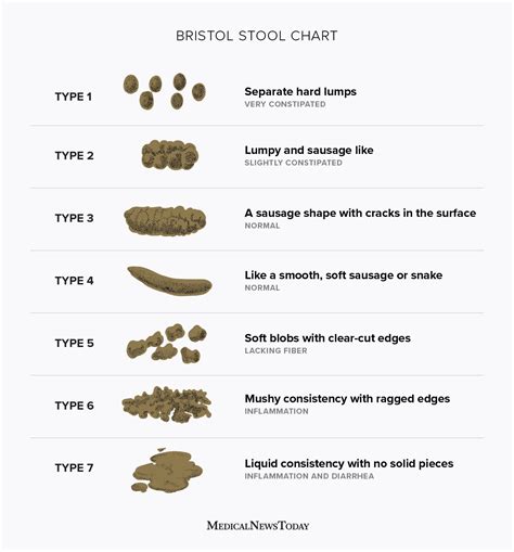 The Incredible Characteristics of Woolly Droppings