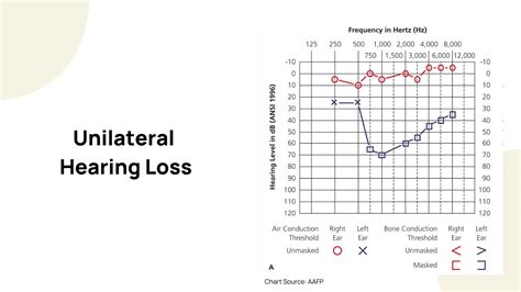 The Influence of Unilateral Hearing Loss on Dream Interpretation