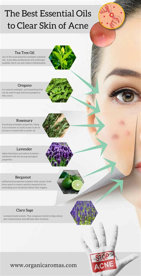 The Ins and Outs of Acne: Essential Information