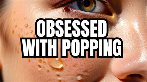 The Intriguing Psychology Behind Our Obsession with Pimple Extractions