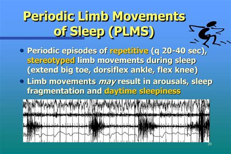 The Relationship between Lower Limb Immobility in Dreamscapes and Sleep Disorders