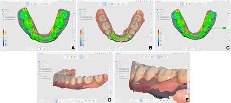 The Role of Dental Professionals in Assessing and Treating Damaged Retaining Devices