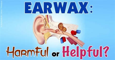 The Role of Earwax: Friend or Foe?