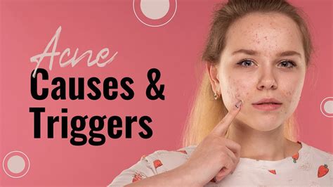 The Scientific Factors Behind Acne: Unraveling the Underlying Triggers