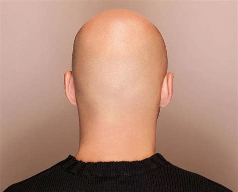 The Significance of Baldness: Exploring the Symbolic Meaning and Emotional Impact of Hair Loss