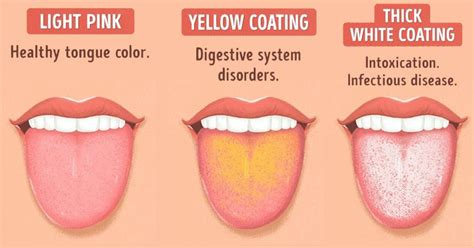 The Significance of Dreaming about Tongue Hygiene