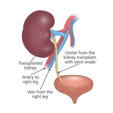 The Significance of Dreams Involving Surgical Procedures on the Kidneys