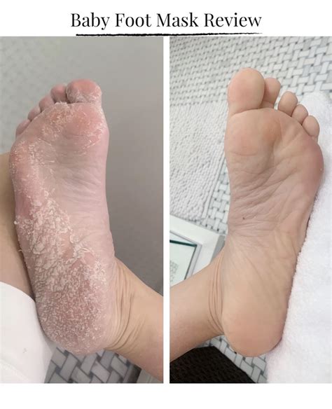 The Significance of Exfoliation for Silky Smooth Feet