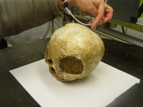 The Significance of Rituals and Superstitions in the Collection of Skeletal Remains