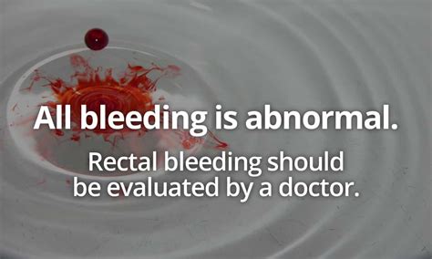 The Startling Reality: Bleeding Anus