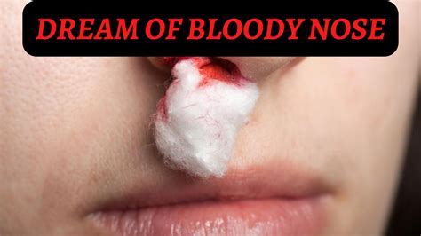 The Symbolic Meaning of Dreams Featuring a Bloodied Nose