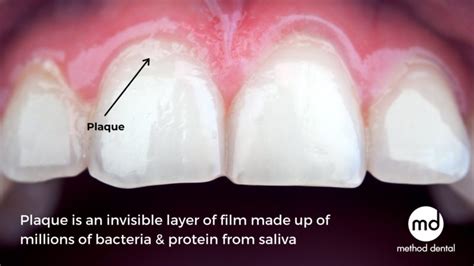 The Symbolism Behind Teeth's Growth: Analysis and Significance