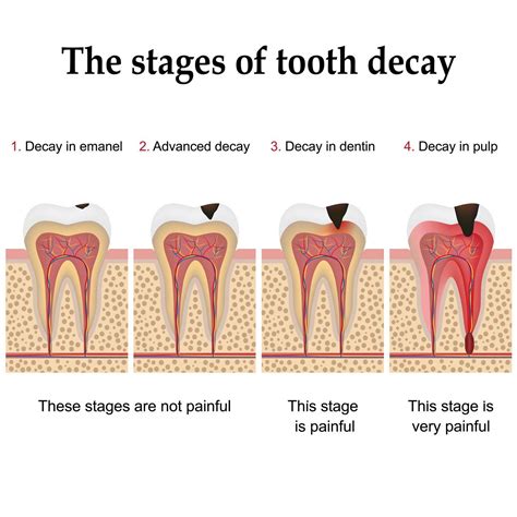 The Symbolism of Decaying Teeth