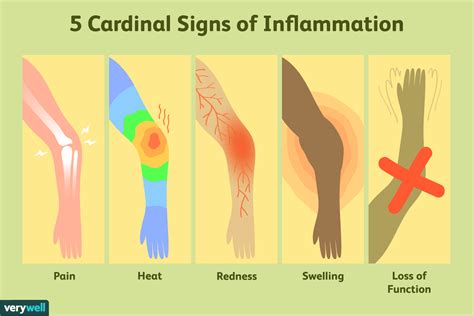 The Symbolism of Inflamed Swellings in Different Cultures
