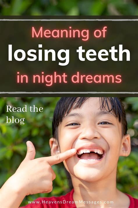 The Symbolism of Losing Teeth in Dreams