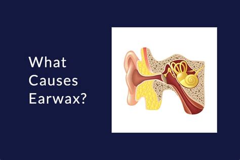 The Unexpected Factors Contributing to Excessive Earwax Production