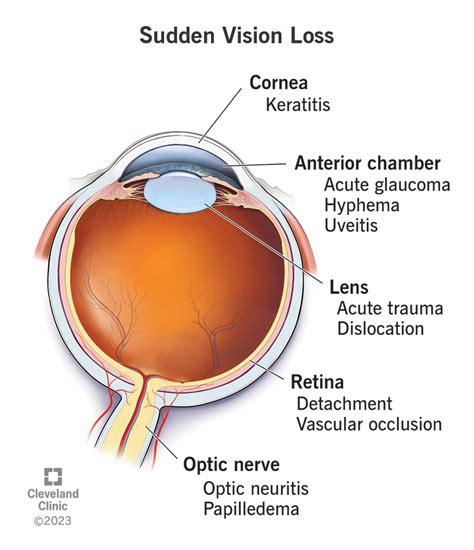 Thoughts on the Fear of Losing Vision