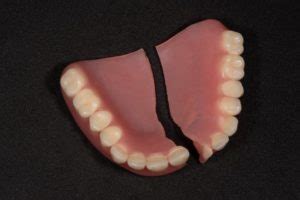 Tips for Dealing with Fractured Dentures