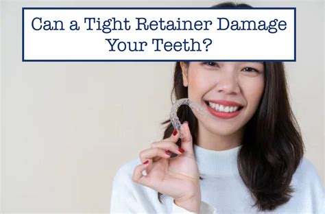 Tips for Preventing Future Retainer Damage