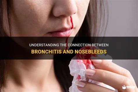 Trauma and Nosebleeds: Understanding the Connection