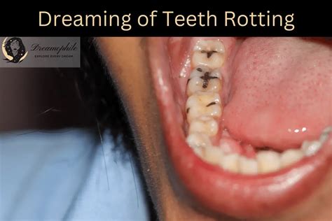 Uncovering Deep-rooted Fears: Delving Into the Symbolism Behind Dreams of Deteriorating Teeth