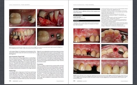 Uncovering the Possible Meanings of Dental Deterioration