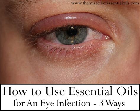 Understanding Eye Infection: Essential Information