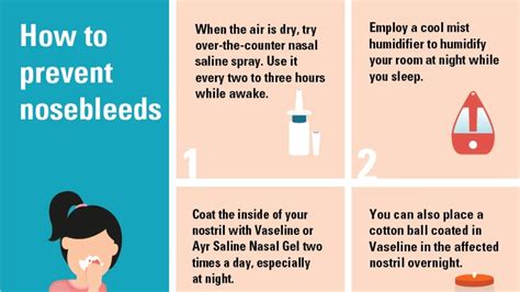 Understanding Nosebleeds: A Comprehensive Overview