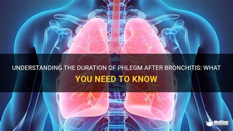 Understanding Phlegm: What You Need to Know