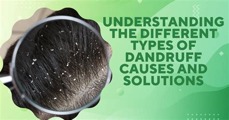 Understanding the Causes of Dandruff