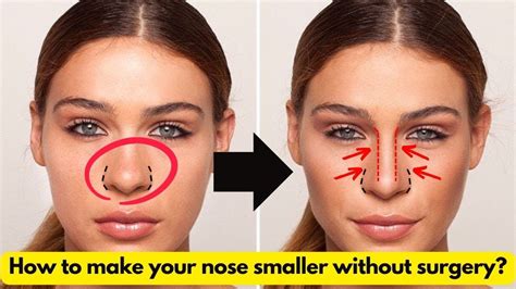 Understanding the Decision to Enhance Your Nasal Appearance