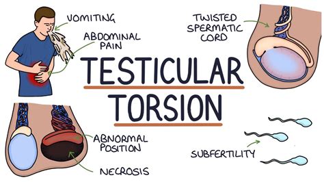 Understanding the Essence of Testicles