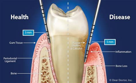 Understanding the Significance of Periodontal Health