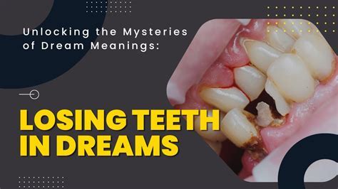 Understanding the Symbolism: Decoding the Meaning of Fractured Teeth in One's Dreams