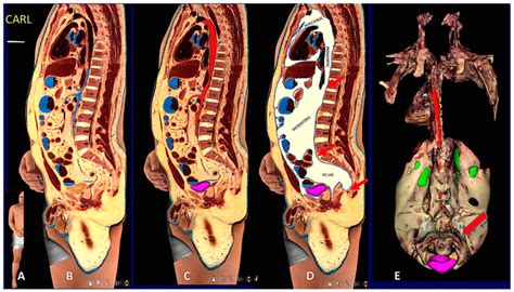 Unraveling the Connection Between Cadaverous Visions and Dread