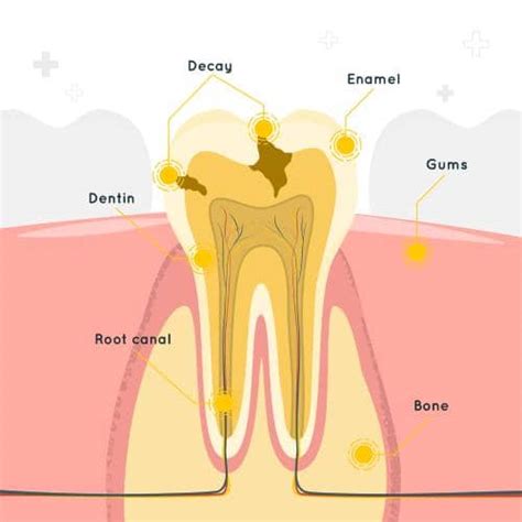 Unveiling the Concealed Messages: Decoding Dental Infections in Reveries