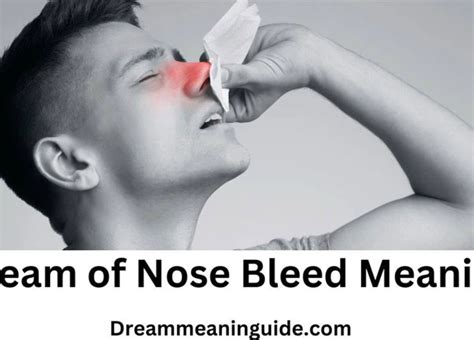 Unveiling the Hidden Meanings of Nasal Hemorrhage in Dreams