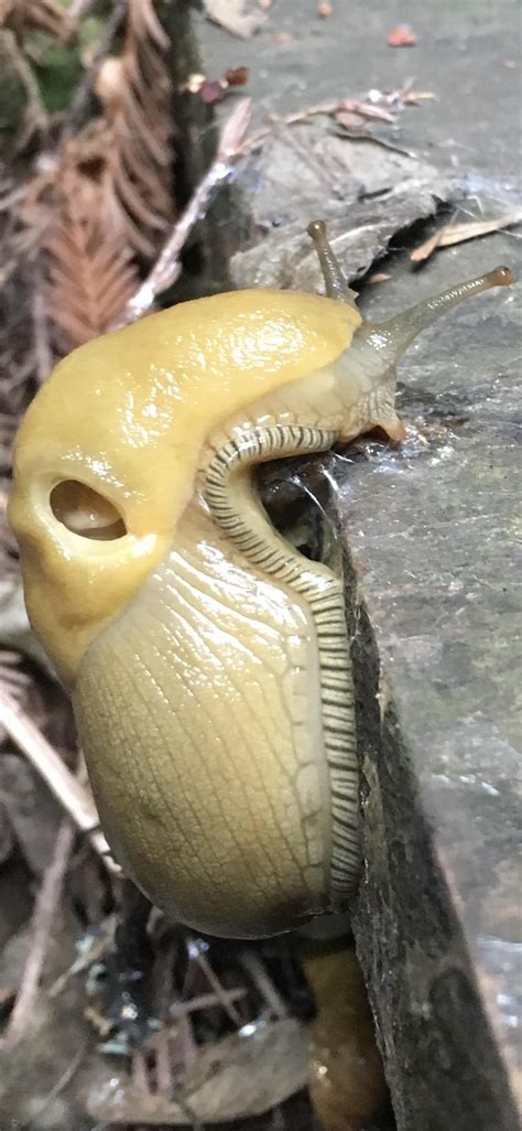 Unveiling the Peculiar Phenomenon of Slugs in the Nasal Cavity During Dream States