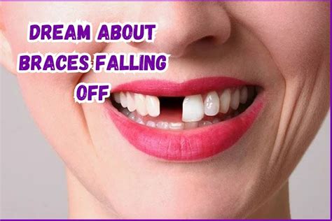 Unveiling the Symbolism: When Braces Come Loose in Dreams